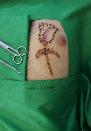 Organ Donation