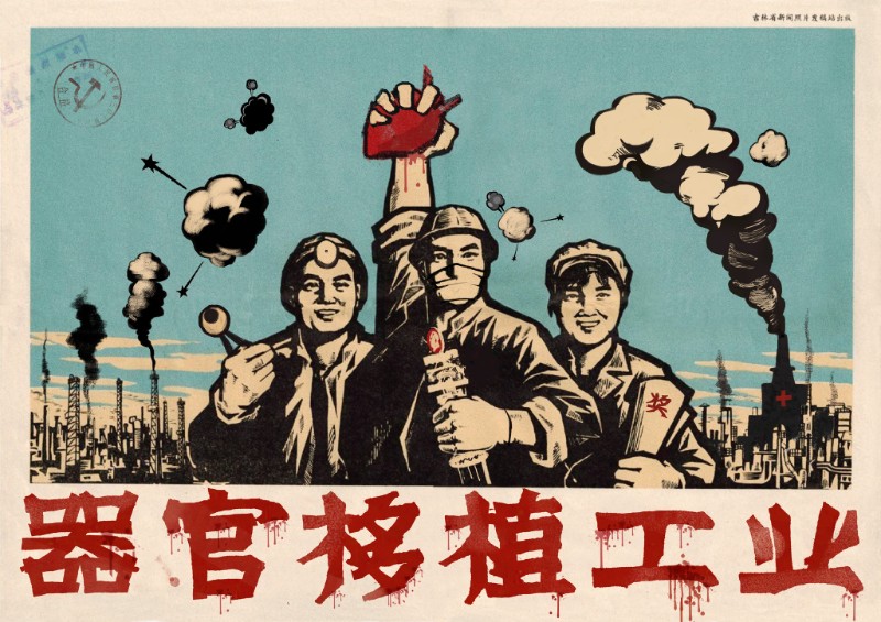 器官移植工業