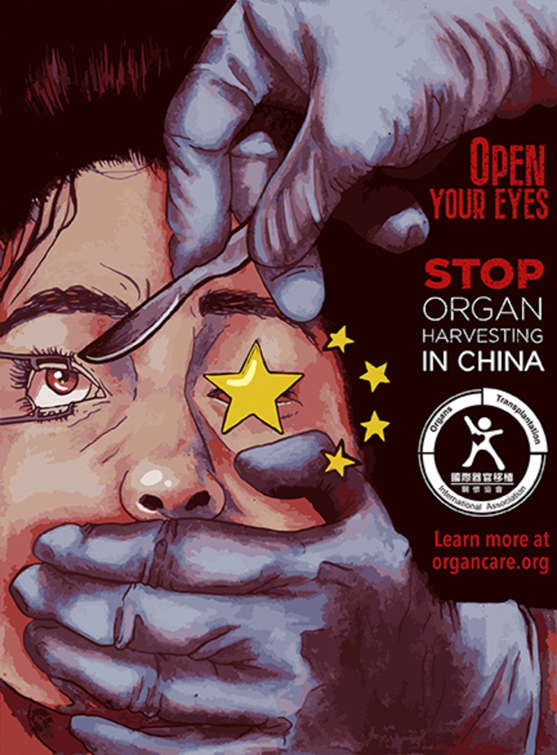 An Eye for and Eye