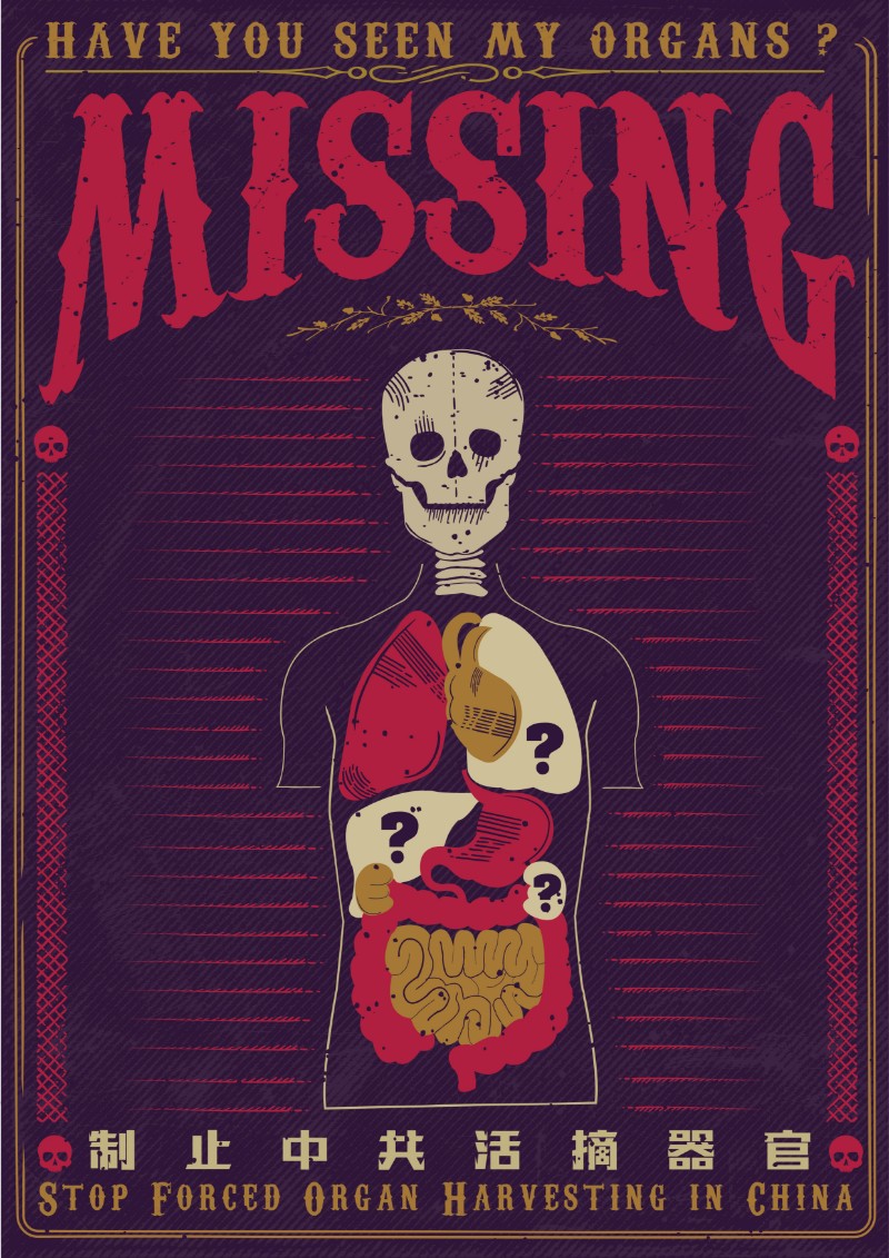 Missing organ