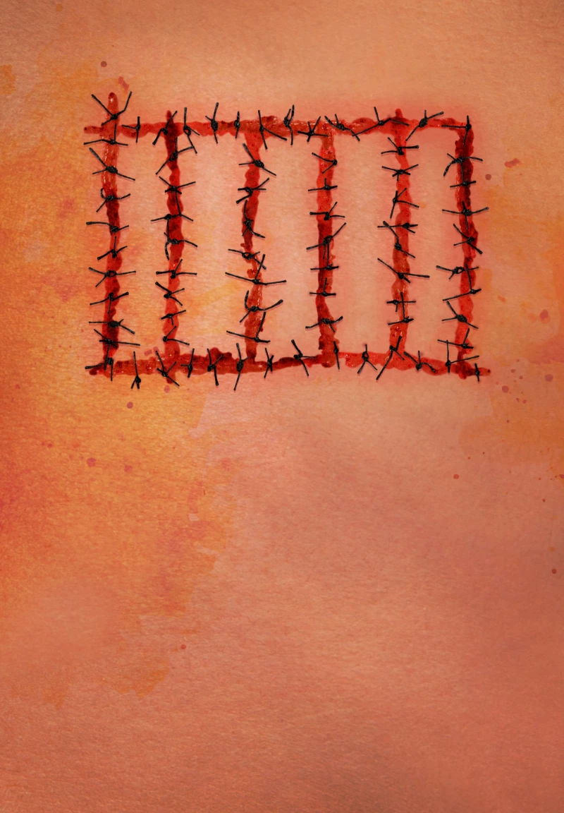  Red Wound /SeriesX3 