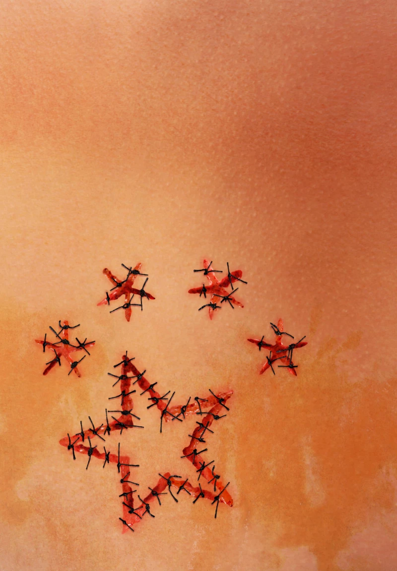  Red Wound /SeriesX3 