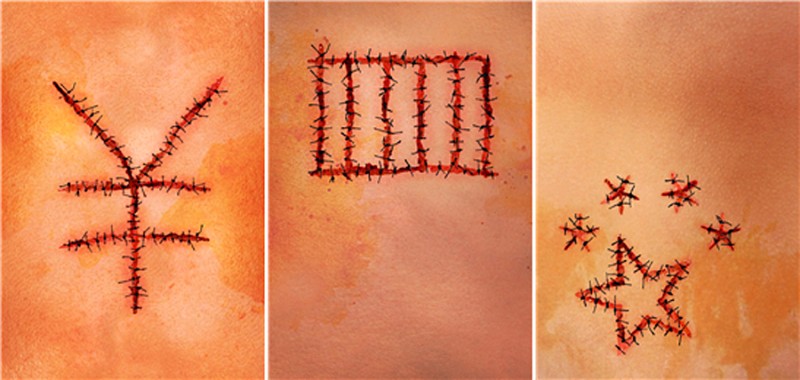 금상 'Red Wound/SeriesX3', 바흐람 가라비 만질리(Bahram Gharavi Manjili), 이란.  바흐람 가라비 만질리는 "흔히 수술 후에는 신체에 자국이나 흉터가 남는다. 이 수술은 신념과 의견이 다른 사람들의 장기를 적출하는 것을 목표로 하기 때문에, 사람의 육신뿐 아니라 '인간성의 몸'에도 서로 다른 흉터와 실밥자국을 남긴다. 작품에서는 이 반인륜적 행위의 과정을 수술의 실밥자국으로 형상화했다"고 설명했다.